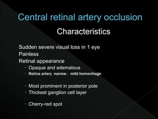 Characteristics
Sudden severe visual loss in 1 eye
Painless
Retinal appearance
 Opaque and edematous
 Retina artery narrow，mild hemorrhage
 Most prominent in posterior pole
 Thickest ganglion cell layer
 Cherry-red spot
 