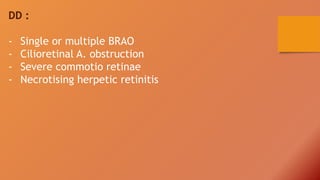 CRAO and BRAO | PPTX