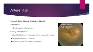 Comprehensive Case Study on Central Retinal Artery Occlusion (CRAO ...