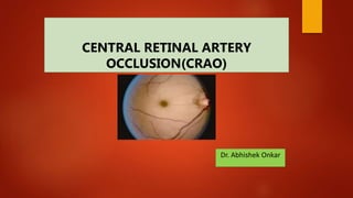 CENTRAL RETINAL ARTERY
OCCLUSION(CRAO)
Dr. Abhishek Onkar
 