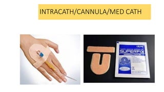 INTRACATH/CANNULA/MED CATH
 