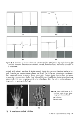 (a) (b) 
(c) (d) 
Figure 5.21 Operation of an unsharp mask, with line profiles of brightness: (a) original image; (b) 
Gaussian smoothed; (c) subtracting smoothed copy (b) from original (a); (d) adding difference (c) 
to original (a). 
smooth (with a larger standard deviation, usually 3 to 6 times greater than first one) removes 
both the noise and important edges, lines, and detail. The difference between the two images 
then keeps only those structures (lines, points, etc.) that are in the intermediate size range 
between the two operators. Rather than being a high pass filter like the Laplacian and unsharp 
mask, the DoG is more properly described as a band pass filter that allows a selected range of 
frequencies or spacings to be kept. 
292 The Image Processing Handbook, Sixth Edition 
Figure 5.22 Application of an 
unsharp mask to an X-ray 
image of a human hand: 
(a) original; 
(b) processed. 
© 2011 by Taylor  Francis Group, LLC 
(a) (b) 
 