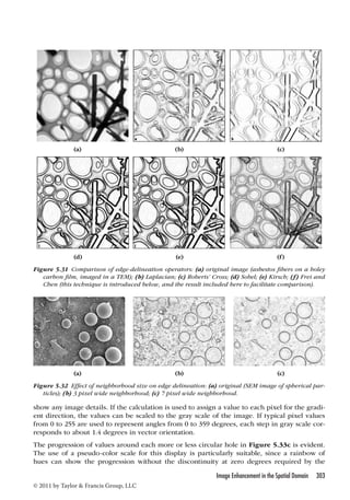 (a) (b) (c) 
(d) (e) (f) 
Figure 5.31 Comparison of edge-delineation operators: (a) original image (asbestos fibers on a holey 
carbon film, imaged in a TEM); (b) Laplacian; (c) Roberts’ Cross; (d) Sobel; (e) Kirsch; (f) Frei and 
Chen (this technique is introduced below, and the result included here to facilitate comparison). 
(a) (b) (c) 
Figure 5.32 Effect of neighborhood size on edge delineation: (a) original (SEM image of spherical par-ticles); 
(b) 3 pixel wide neighborhood; (c) 7 pixel wide neighborhood. 
show any image details. If the calculation is used to assign a value to each pixel for the gradi-ent 
direction, the values can be scaled to the gray scale of the image. If typical pixel values 
from 0 to 255 are used to represent angles from 0 to 359 degrees, each step in gray scale cor-responds 
The progression of values around each more or less circular hole in Figure 5.33c is evident. 
The use of a pseudo-color scale for this display is particularly suitable, since a rainbow of 
hues can show the progression without the discontinuity at zero degrees required by the 
Image Enhancement in the Spatial Domain 303 
to about 1.4 degrees in vector orientation. 
© 2011 by Taylor  Francis Group, LLC 
 