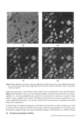 (a) (b) 
(c) (d) 
Figure 5.44 Application of texture operators: (a) original TEM image of liver tissue; (b) Haralick angu-lar 
second moment; (c) entropy; (d) slope from the fractal texture calculation with a maximum 
apply the same logic as the human vision system does to perform the same discrimination. 
Figure 5.44 illustrates the use of the Haralick angular second moment operator (ƒ2 above) 
applied in a moving neighborhood centered on each pixel to calculate a texture value, 
which is then assigned to the pixel. The figure also shows the entropy calculated in a cir-cular 
neighborhood (radius = 3), and the result of the fractal texture calculation described 
below, for comparison. 
A broad range of statistical, frequency, and other local measures of pixel variations are used 
to extract various aspects of texture from images, either for measurement or to assist in seg-menting 
the original image into regions (Heeger  Bergen, 1995; Barth et al., 1998; de Bonet 
316 The Image Processing Handbook, Sixth Edition 
© 2011 by Taylor  Francis Group, LLC 
radius of 6 pixels. 
 