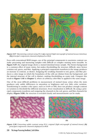 (a) (b) 
Figure 5.57 Maximizing contrast using PCA: (a) original (light micrograph of stained mouse intestine); 
Even with conventional RGB images, use of the principal components to maximize contrast can 
make processing and measuring samples with difficult or complex staining more tractable. In 
Figure 5.57, the original image shows a stained intestinal tissue sample. The brown background 
is a common effect of many stains, but makes thresholding the structure difficult, since brown 
contains red, green, and blue. Applying a principal components transform to the image produces 
an increase in contrast, as shown. Assigning the resulting channels to red, green, and blue pro-duces 
a color image in which the boundaries of the cells are distinct from the background, and 
the internal structure of the cell is distinct, making thresholding an easier task. Compare this 
result to Figure 1.46 in Chapter 1, where an arbitrary color filter is applied to the same image. 
One of the most difficult problems in measurement of stained tissue arises when the stain 
produces only subtle differences in saturation or brightness and very little color variation. 
Transforming to another color space, such as L•a•b or HSI, does not produce enough contrast 
or variation to threshold the different structures. Even visualization is difficult. By using a prin-cipal 
components transform and assigning the channels to the red, green, and blue channels for 
display (Figure 5.58), the structure is revealed clearly and measurements can be made. 
330 The Image Processing Handbook, Sixth Edition 
© 2011 by Taylor  Francis Group, LLC 
(b) principal components channels displayed as RGB. 
(a) (b) 
Figure 5.58 Converting subtle contrast using PCA: original (light micrograph of stained tissue); (b) 
principal components channels displayed as RGB. 
 