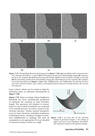 (a) (b) (c) 
Figure 7.35 Thresholding the processed image from Figure 7.31a: (a) smoothing with a Gaussian ker-nel, 
standard deviation = 1 pixel; (b) the boundary produced by thresholding image (a), superim-posed 
on the original; (c) Median processing (iteratively applied until no further changes occurred); 
(d) the boundary produced by thresholding image (c), superimposed on the original; (e) compari-son 
of the boundaries in Figures 7.33a (red), 7.35b (green), and 7.35d (blue) by placing the lines 
into color channels (white, cyan, yellow, and magenta pixels indicate overlaps between the various 
boundaries). 
Segmentation and Thresholding 425 
(d) (e) 
lower values), which can be solved to find the 
minimum point, as indicated schematically in 
Figure 7.36. 
Figure 7.37 shows an image whose brightness 
threshold has been automatically positioned 
to minimize the variation in total boundary 
length. The specimen (oil droplets in mayon-naise) 
is one in which boundaries are expected 
to be smooth because of surface tension at the 
oil-water interface. Similar smooth boundaries 
occur in many situations, including membranes 
in biological tissue, and phase changes in mate-rials 
(solidification or melting), but such an 
assumption is not appropriate for (e.g.) abraded 
or fractured surfaces which are rough. 
© 2011 by Taylor  Francis Group, LLC 
Figure 7.36 A two-way plot of the absolute 
change in perimeter length vs. the settings of 
upper and lower level brightness thresholds. 
The minimum indicates the optimal settings. 
 