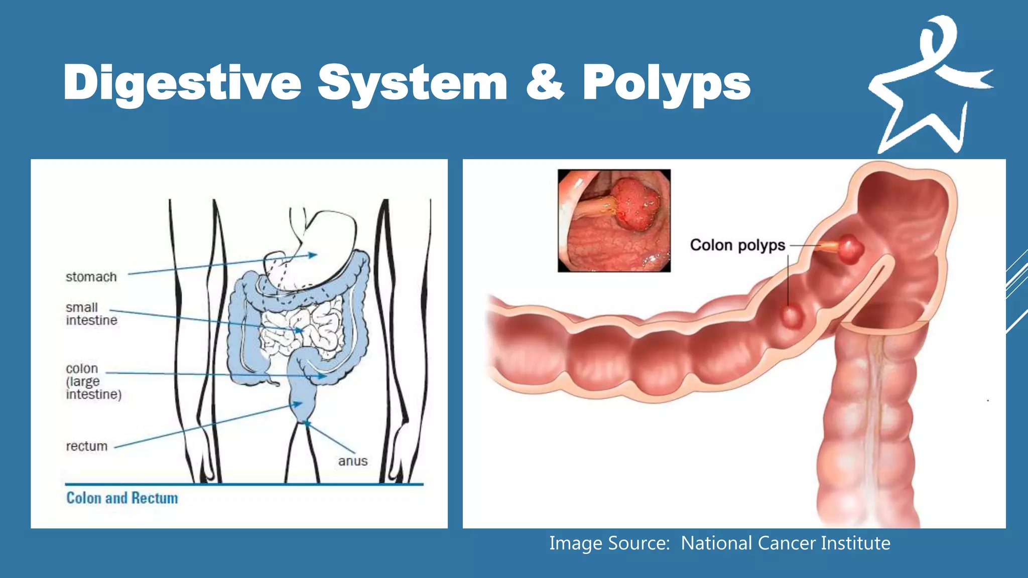 Digestive System & Polyps
Image Source: National Cancer Institute
 