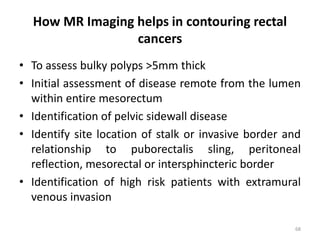 How MR Imaging helps in contouring rectal
cancers
• To assess bulky polyps >5mm thick
• Initial assessment of disease remote from the lumen
within entire mesorectum
• Identification of pelvic sidewall disease
• Identify site location of stalk or invasive border and
relationship to puborectalis sling, peritoneal
reflection, mesorectal or intersphincteric border
• Identification of high risk patients with extramural
venous invasion
68
 