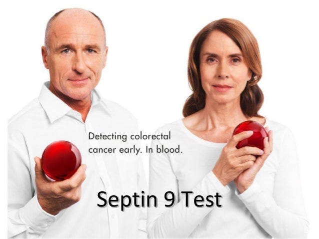 septin test blood 9 Family  for Screening New Cancer  What's Colorectal Physicians