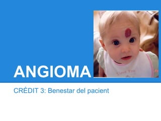 ANGIOMA
CRÈDIT 3: Benestar del pacient
 