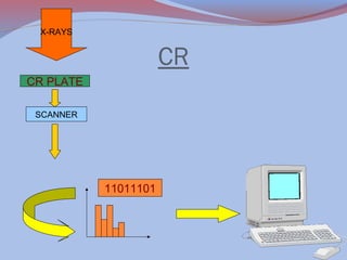 X-RAYS

CR
CR PLATE
SCANNER

11011101

 