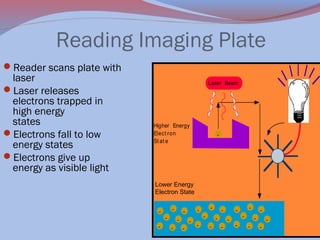 Reading Imaging Plate
Reader scans plate with

laser
Laser releases
electrons trapped in
high energy
states
Electrons fall to low
energy states
Electrons give up
energy as visible light

Laser Beam

Higher Energy
Elect ron
St at e

-

Lower Energy
Electron State
Lower Energy
Elect ron
St at e

-

-

-

-

-

-

-

-

-

-

-

-

-

-

-

-

 