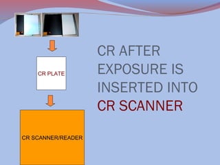 CR PLATE

CR SCANNER/READER

CR AFTER
EXPOSURE IS
INSERTED INTO
CR SCANNER

 