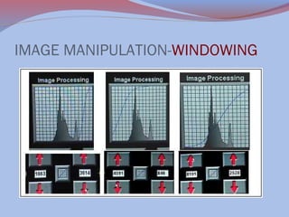 IMAGE MANIPULATION-WINDOWING

 