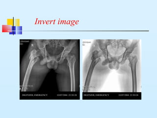 Invert image
DIGITIZER, EMERGENCY 1O/07/2004 22:3O:28 DIGITIZER, EMERGENCY 1O/07/2004 22:3O:28
 