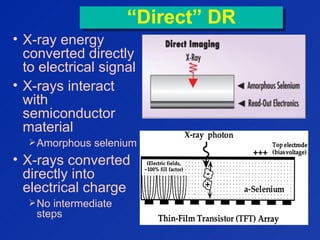 “Direct” DR“Direct” DR
• X-ray energy
converted directly
to electrical signal
• X-rays interact
with
semiconductor
material
Amorphous selenium
• X-rays converted
directly into
electrical charge
No intermediate
steps
 