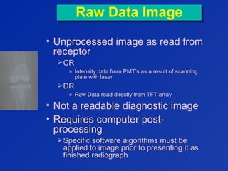 Raw Data ImageRaw Data Image
• Unprocessed image as read from
receptor
CR
» Intensity data from PMT’s as a result of scanning
plate with laser
DR
» Raw Data read directly from TFT array
• Not a readable diagnostic image
• Requires computer post-
processing
Specific software algorithms must be
applied to image prior to presenting it as
finished radiograph
 