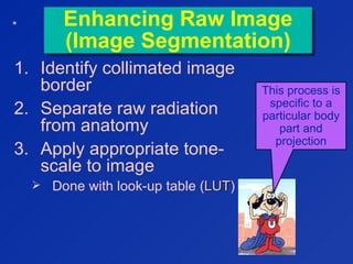 Enhancing Raw Image
(Image Segmentation)
Enhancing Raw Image
(Image Segmentation)
1. Identify collimated image
border
2. Separate raw radiation
from anatomy
3. Apply appropriate tone-
scale to image
 Done with look-up table (LUTLUT)
This process is
specific to a
particular body
part and
projection
*
 
