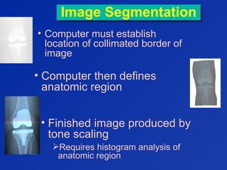 Image SegmentationImage Segmentation
• Computer must establish
location of collimated border of
image
• Computer then defines
anatomic region
• Finished image produced by
tone scaling
Requires histogram analysis of
anatomic region
 