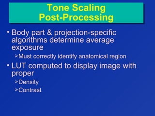 Tone Scaling
Post-Processing
Tone Scaling
Post-Processing
• Body part & projection-specific
algorithms determine average
exposure
Must correctly identify anatomical region
• LUT computed to display image with
proper
Density
Contrast
 