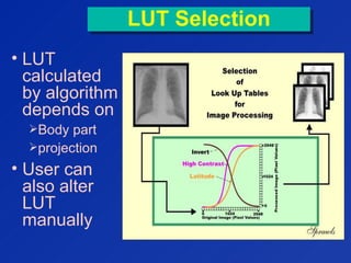LUT SelectionLUT Selection
• LUT
calculated
by algorithm
depends on
Body part
projection
• User can
also alter
LUT
manually
 