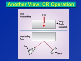 Another View: CR OperationAnother View: CR Operation
 