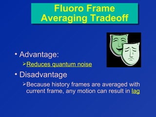 Fluoro Frame
Averaging Tradeoff
Fluoro Frame
Averaging Tradeoff
• Advantage:
Reduces quantum noise
• Disadvantage
Because history frames are averaged with
current frame, any motion can result in lag
 