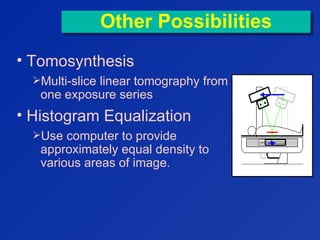 Other PossibilitiesOther Possibilities
• Tomosynthesis
Multi-slice linear tomography from
one exposure series
• Histogram Equalization
Use computer to provide
approximately equal density to
various areas of image.
 