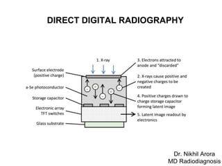 DIRECT DIGITAL RADIOGRAPHY
Dr. Nikhil Arora
MD Radiodiagnosis
 