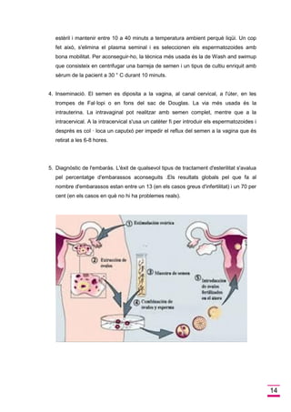 14 
estèril i mantenir entre 10 a 40 minuts a temperatura ambient perquè liqüi. Un cop fet això, s'elimina el plasma seminal i es seleccionen els espermatozoides amb bona mobilitat. Per aconseguir-ho, la tècnica més usada és la de Wash and swimup que consisteix en centrifugar una barreja de semen i un tipus de cultiu enriquit amb sèrum de la pacient a 30 ° C durant 10 minuts. 
4. Inseminació. El semen es diposita a la vagina, al canal cervical, a l'úter, en les trompes de Fal·lopi o en fons del sac de Douglas. La via més usada és la intrauterina. La intravaginal pot realitzar amb semen complet, mentre que a la intracervical. A la intracervical s'usa un catèter fi per introduir els espermatozoides i després es col · loca un caputxó per impedir el reflux del semen a la vagina que és retirat a les 6-8 hores. 
5. Diagnòstic de l'embaràs. L'èxit de qualsevol tipus de tractament d'esterilitat s'avalua pel percentatge d'embarassos aconseguits .Els resultats globals pel que fa al nombre d'embarassos estan entre un 13 (en els casos greus d'infertilitat) i un 70 per cent (en els casos en què no hi ha problemes reals). 
 