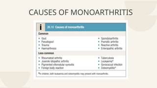CAUSES OF MONOARTHRITIS
 