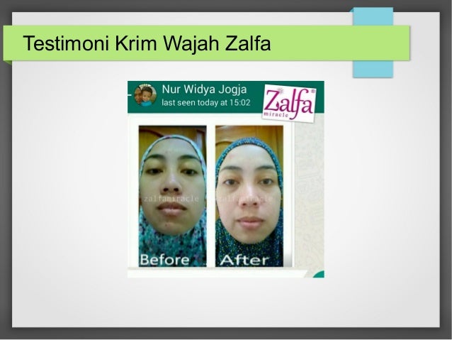 Bedak Untuk Aman Yg Pemutih Hamil Ibu