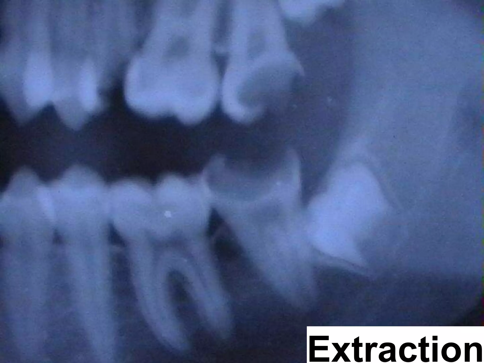 Creating Knowledge out of Interlinked Data Sören Auer – WIMS: Creating Knowledge out of Linked Data 26.5.2011 Page 7 http://lod2.eu Extraction 