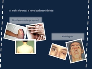 Los niveles inferiores a lo normal pueden ser indicio de:


    Distrofia muscular (etapa avanzada)




                                                            Miastenia grave
 