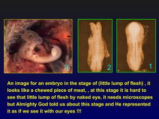 3                  2                  1

An image for an embryo in the stage of (little lump of flesh) , it
looks like a chewed piece of meat, , at this stage it is hard to
see that little lump of flesh by naked eye, it needs microscopes
but Almighty God told us about this stage and He represented
it as if we see it with our eyes !!!
 