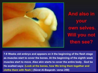 And also in
                                                        your
                                                    own selves.
                                                    Will you not
                                                     then see?

7-8 Weeks old embryo and appears on it the beginning of the flesh stage
as muscles start to cover the bones. At the beginning of the eighth week
muscles start to move. Also skin starts to cover the entire body . God be
He exalted says: (Look at the bones, how We bring them together and
clothe them with flesh ) (Sûrat Al-Baqarah- verse 259)
 