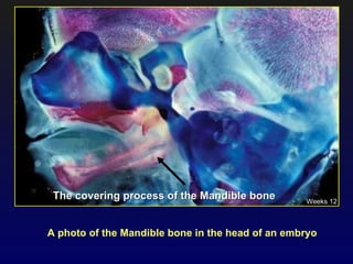The covering process of the Mandible bone        Weeks 12



A photo of the Mandible bone in the head of an embryo
 