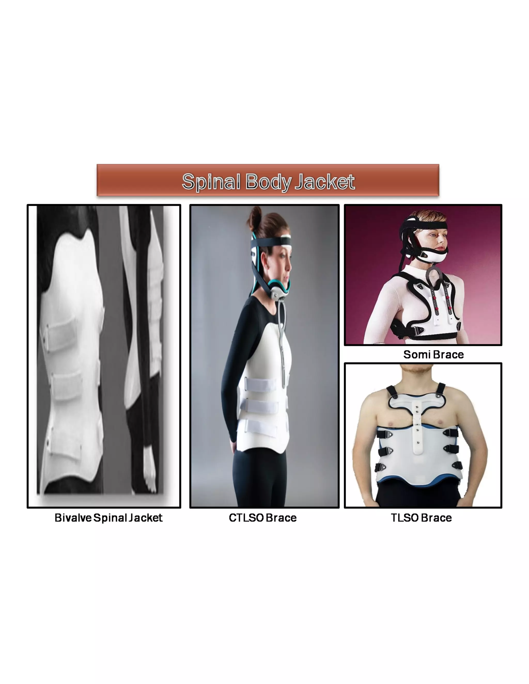 Creative orthotic and prosthetic solutions product catalogue PDF