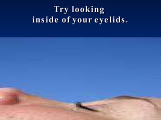 Try looking  inside of your eyelids. 