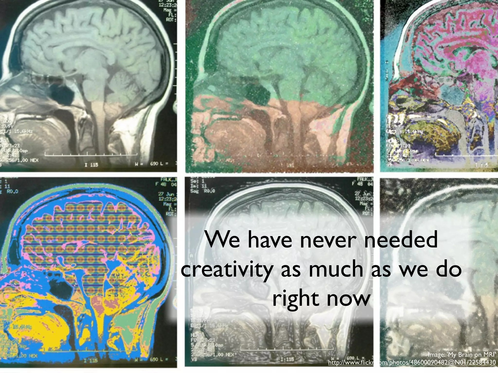 We have never needed
creativity as much as we do
          right now

                                               Image: 'My Brain on MRI'
              http://www.ﬂickr.com/photos/48600090482@N01/22584430
 