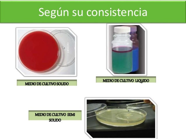 Mediso de cultivo & Crecimiento bacteriano