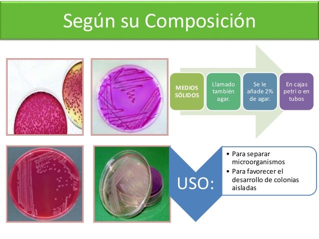 Mediso de cultivo & Crecimiento bacteriano