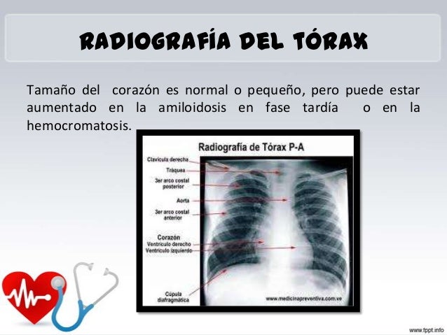 Los cinturones ortopédicos a la osteocondrosis