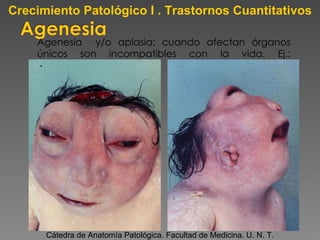 Agenesia  y/o aplasia: cuando afectan órganos únicos son incompatibles con la vida. Ej.: anencefalia. Cátedra de Anatomía Patológica. Facultad de Medicina. U. N. T. Crecimiento Patológico I . Trastornos Cuantitativos 