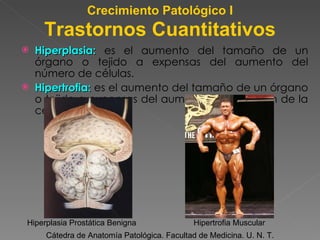 Hiperplasia:  es el aumento del tamaño de un órgano o tejido a expensas del aumento del número de células. Hipertrofia:  es el aumento del tamaño de un órgano o tejido a expensas del aumento del volumen de la célula. Cátedra de Anatomía Patológica. Facultad de Medicina. U. N. T. Trastornos Cuantitativos Crecimiento Patológico I Hiperplasia Prostática Benigna Hipertrofia Muscular 