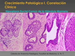 Cátedra de Anatomía Patológica. Facultad de Medicina. U. N. T. 