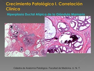 Cátedra de Anatomía Patológica. Facultad de Medicina. U. N. T. 
