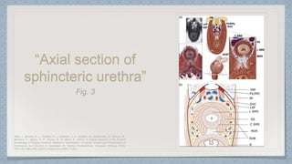 “Axial section of
sphincteric urethra”
 