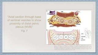 “Axial section through base
of seminal vesicles to show
proximity of distal pelvic
plexus (NVB)”
 
