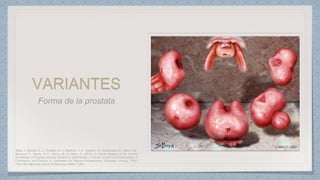 VARIANTES
 